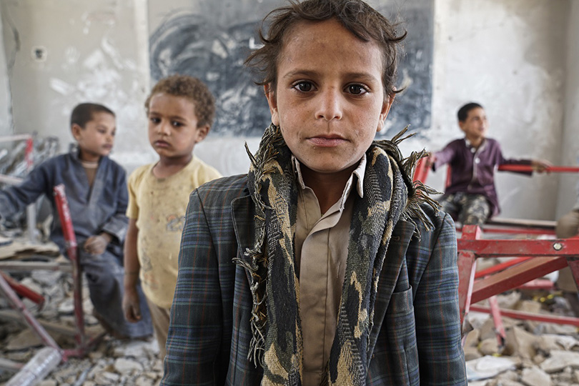 مرصد التعليم يرصد أطفال اليمن ويحكي قصتهم